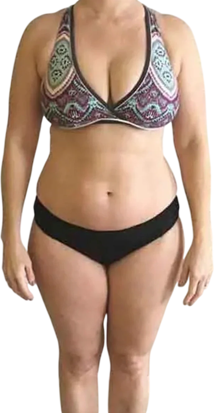 GLP-1 Weight Loss before